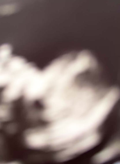 Sonogram Picture Frame Ornament